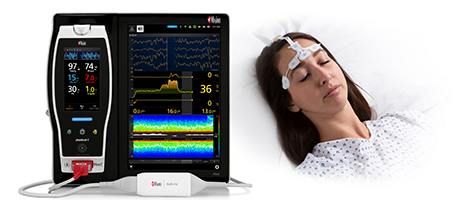 patient wearing the masimo sedline brain functioning monitor