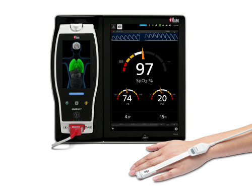 Masimo SedLine® Brain Function Monitoring