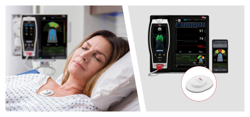 Masimo Root® with O3® Regional Oximetry and SedLine® Brain Function Monitoring