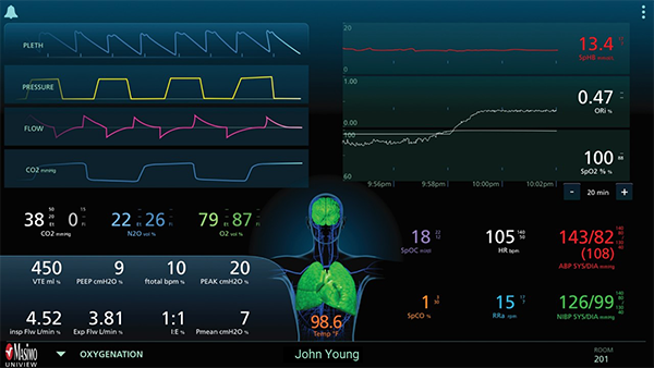 Masimo - UniView - Disposition oxygénation